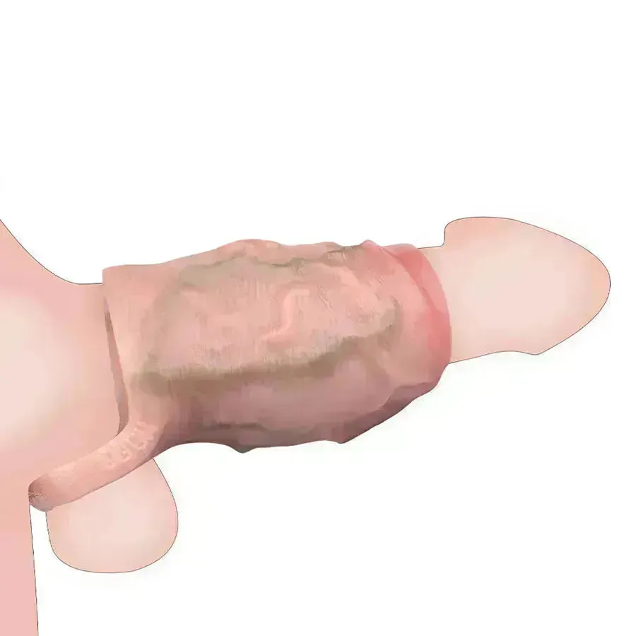 Xinghaoya Silicone Thick Penis Sleeve